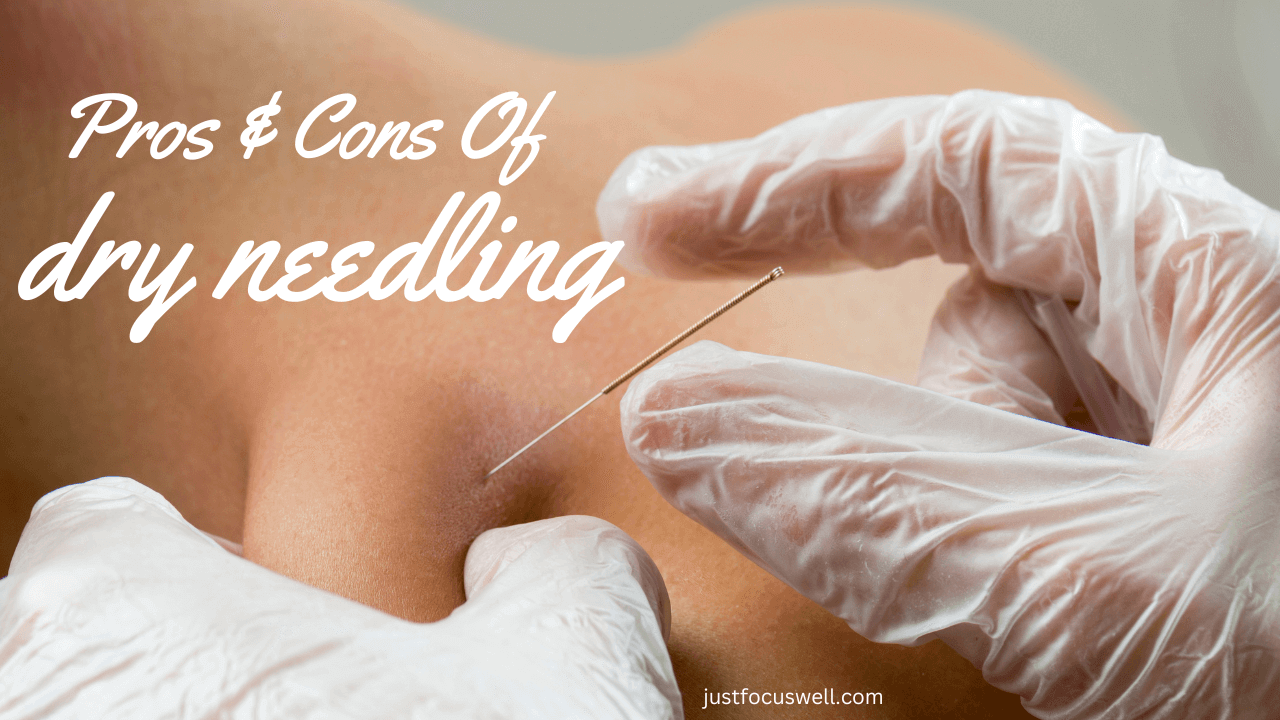 The Pros & Cons Of Dry Needling