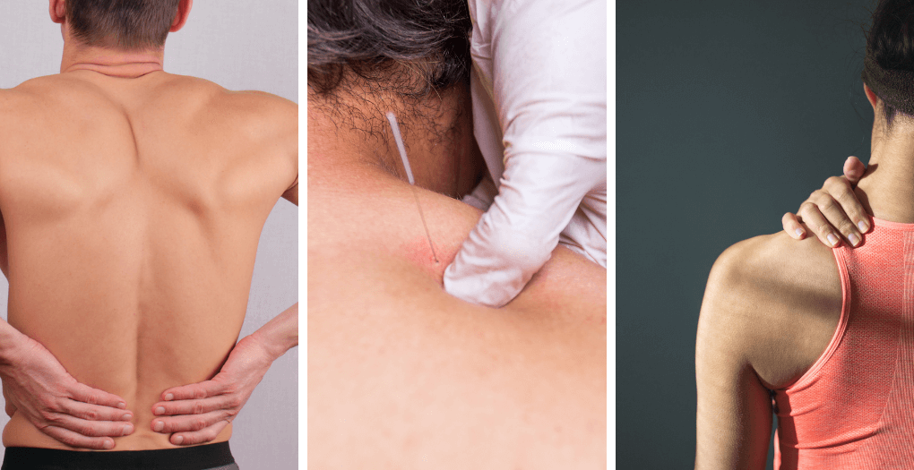 What Are The Pros And Cons Of Dry Needling?