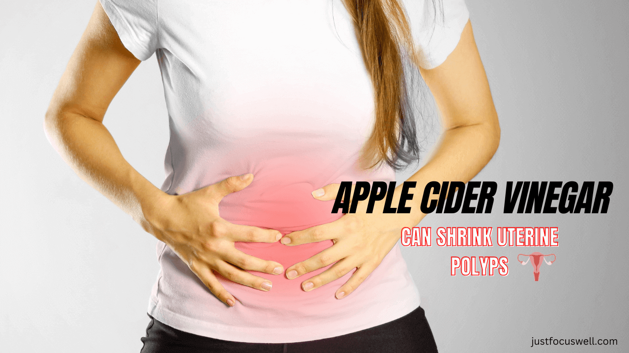 Apple Cider Vinegar Can Shrink Uterine Polyps?