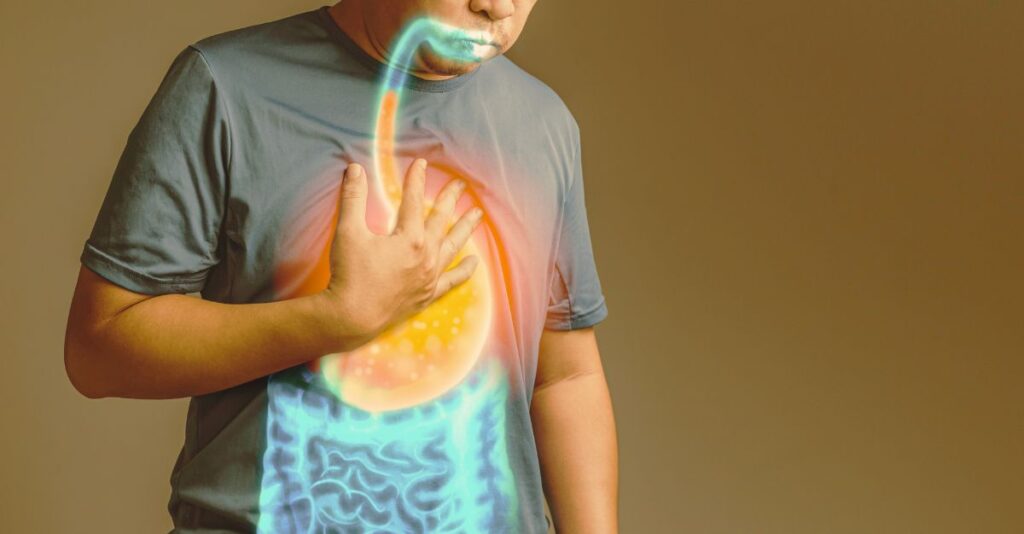 What Is Acid Reflux And Its Symptoms